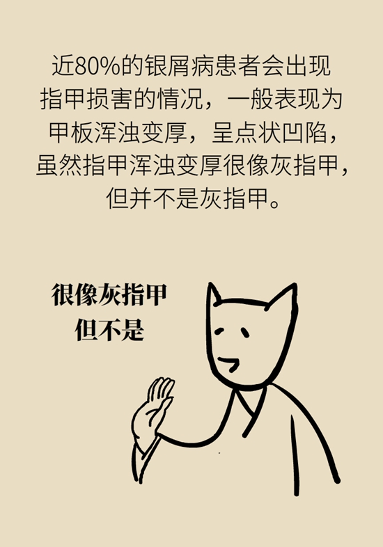 甩不掉的牛皮癣如何防治？3个误区要纠正392 / 作者:UFO爱好者 / 帖子ID:68752