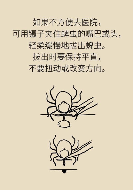 被蚊叮虫咬怎么办？医生建议做好3件事122 / 作者:UFO爱好者 / 帖子ID:68382