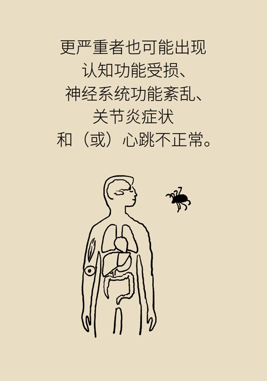 被蚊叮虫咬怎么办？医生建议做好3件事697 / 作者:UFO爱好者 / 帖子ID:68382