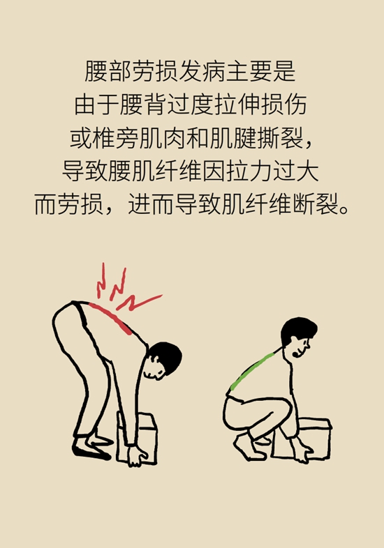 年纪轻轻也没干啥体力活儿，怎么就腰肌劳损了？981 / 作者:UFO爱好者 / 帖子ID:68509