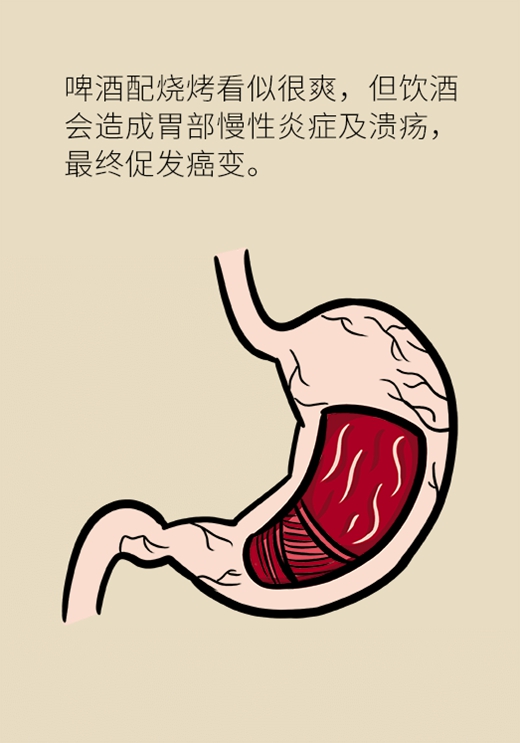 最易惹上胃癌的坏习惯，看你中了几个258 / 作者:UFO爱好者 / 帖子ID:68345
