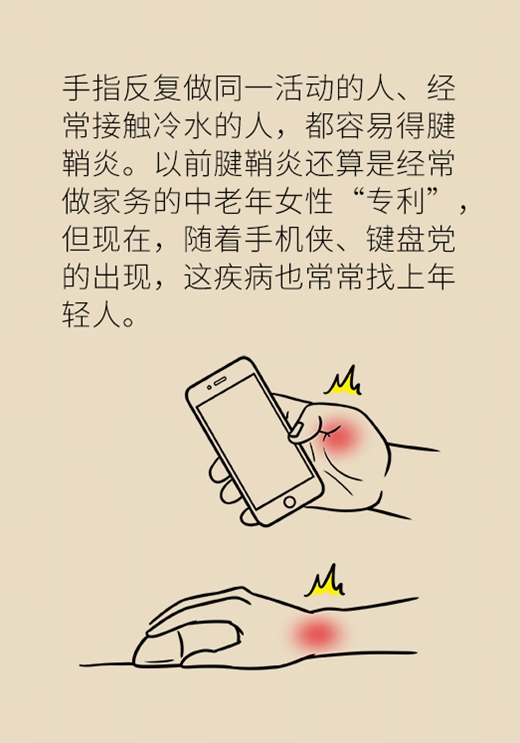 手上有包一按就疼？手机玩多了都可能得这种病252 / 作者:UFO爱好者 / 帖子ID:68338