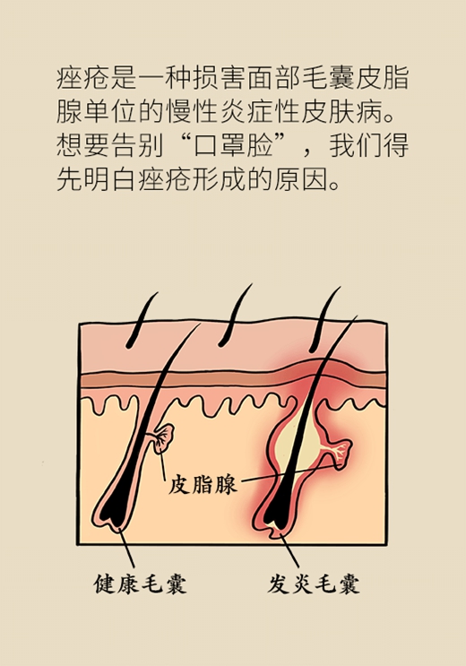 口罩不知道何时摘？学会这样做和“口罩脸”说拜拜480 / 作者:UFO爱好者 / 帖子ID:68326