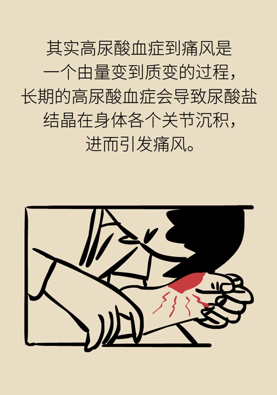 为啥痛风好了又犯？你可能治的是“痛”而不是“痛风”410 / 作者:UFO爱好者 / 帖子ID:67807