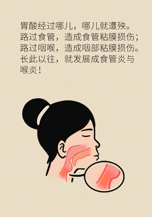 催吐减肥真那么简单吗？小心患上厌食症518 / 作者:UFO爱好者 / 帖子ID:67625