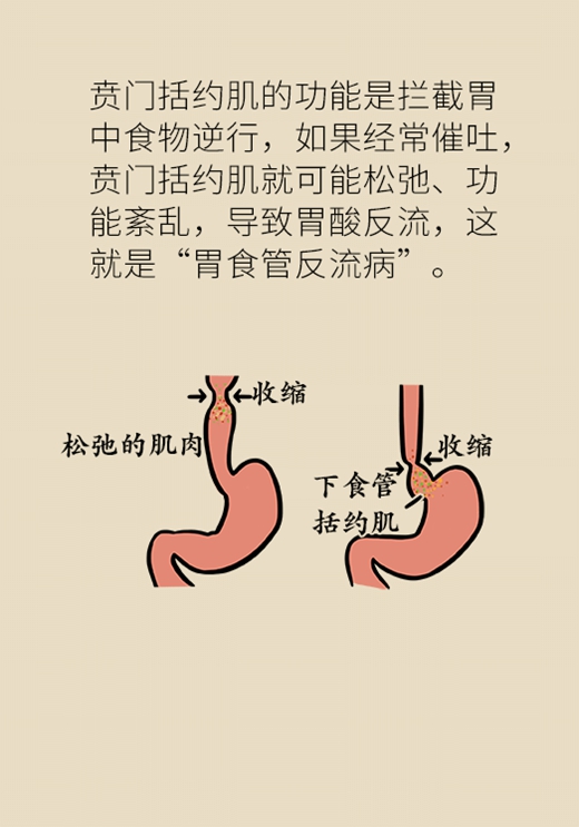 催吐减肥真那么简单吗？小心患上厌食症116 / 作者:UFO爱好者 / 帖子ID:67625