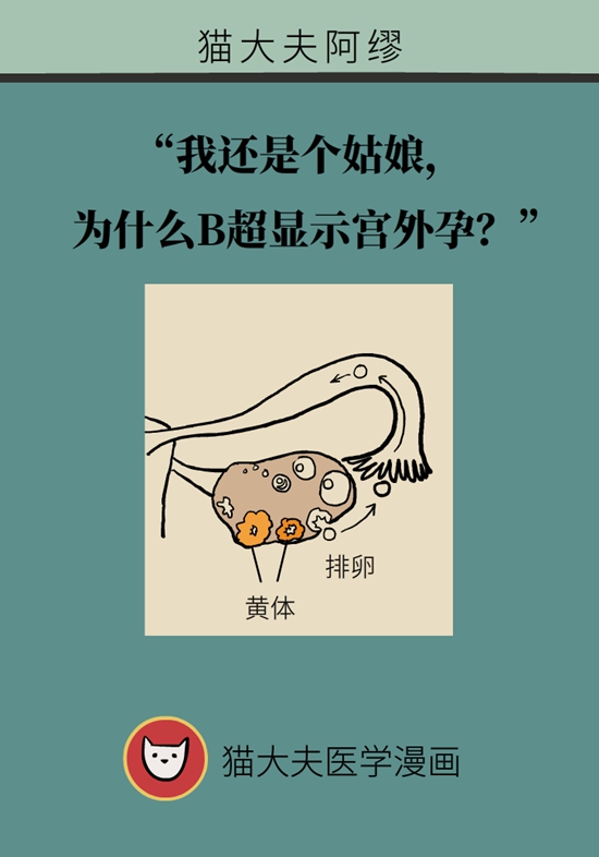 这种腹痛常被误认宫外孕，背后诱因要牢记8 / 作者:UFO爱好者 / 帖子ID:67622