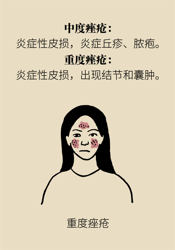 痘痘长个没完！是时候查一查你的食物清单了196 / 作者:UFO爱好者 / 帖子ID:67609