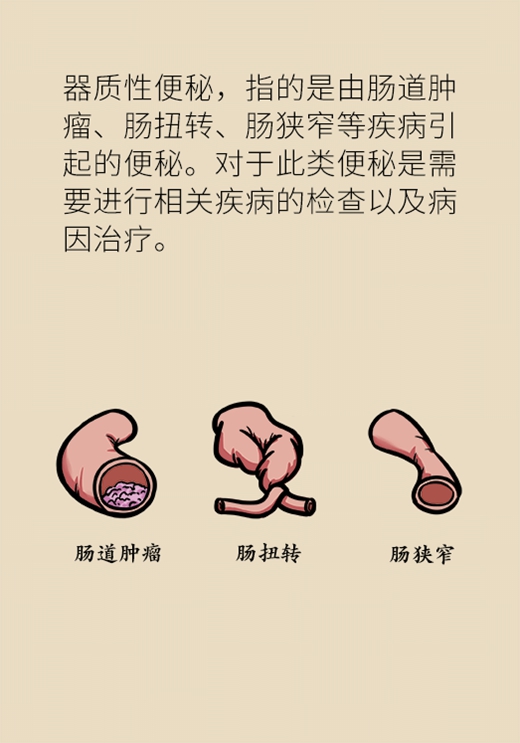 肠道堵车，香蕉疏通？错！真正有用的是这6招165 / 作者:UFO爱好者 / 帖子ID:72554
