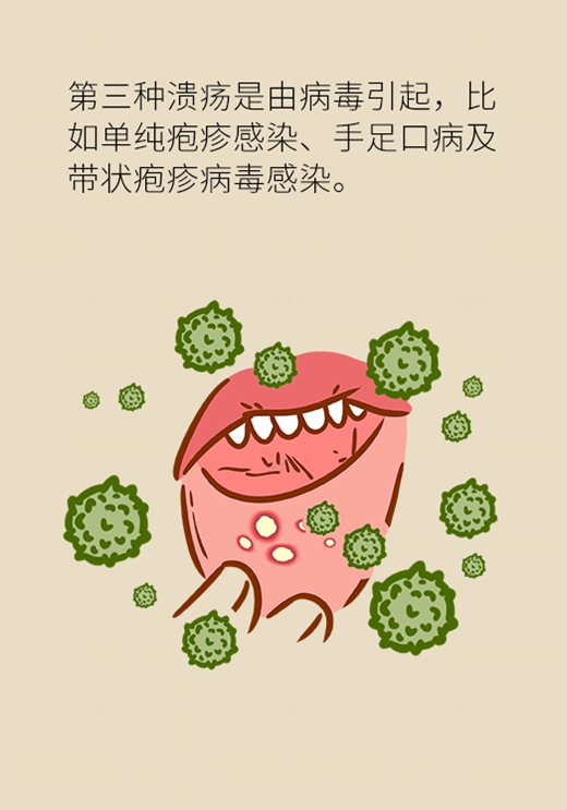 口腔溃疡反复发作或是大病先兆，快去这些科室检查492 / 作者:UFO爱好者 / 帖子ID:72586