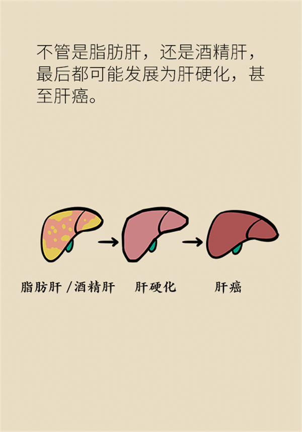 有这个生活习惯的人注意！当心陷入肝癌深渊83 / 作者:UFO爱好者 / 帖子ID:72732