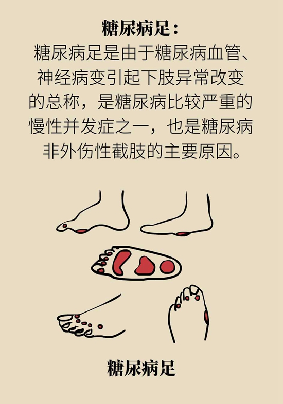 我国老年糖尿病患者超三千万！可怕的并发症必须得防456 / 作者:UFO爱好者 / 帖子ID:72757