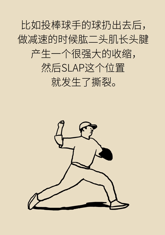 健身房里最常发生的肩痛，该怎么应对？481 / 作者:UFO爱好者 / 帖子ID:72764