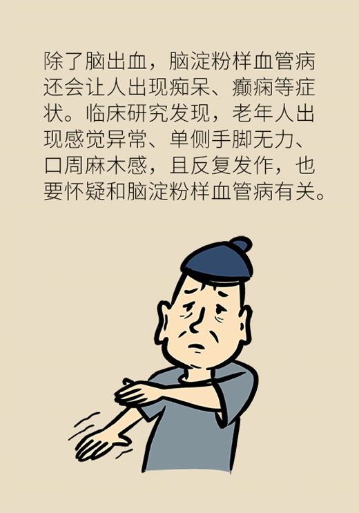 记性变差容易瞌睡，有可能是这种脑出血481 / 作者:UFO爱好者 / 帖子ID:72921