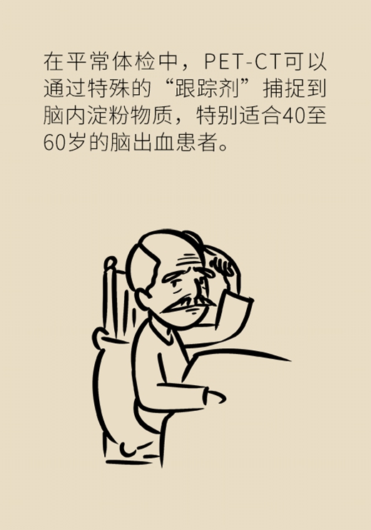 记性变差容易瞌睡，有可能是这种脑出血670 / 作者:UFO爱好者 / 帖子ID:72921