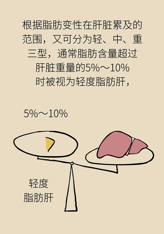得了脂肪肝不用吃药，做好这件事就行957 / 作者:UFO爱好者 / 帖子ID:72935