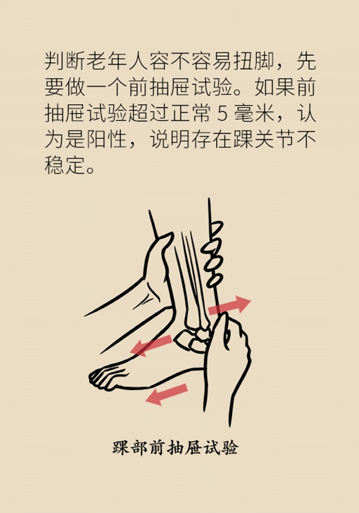 动不动崴脚与这疾病相关！解决方法遵循POLICE原则555 / 作者:UFO爱好者 / 帖子ID:72932