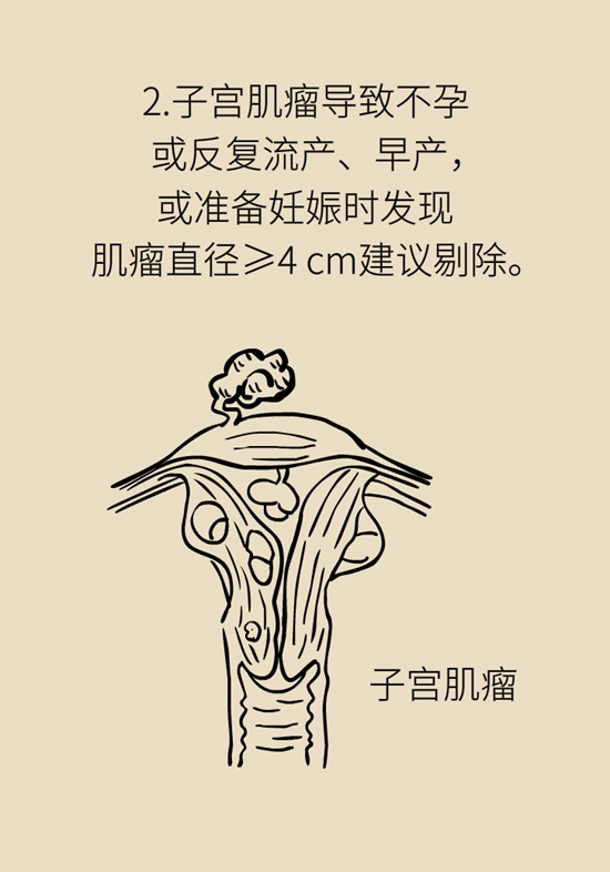 得了子宫肌瘤就一定要切除？看看医生怎么说876 / 作者:UFO爱好者 / 帖子ID:72930