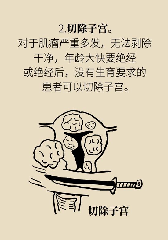 得了子宫肌瘤就一定要切除？看看医生怎么说750 / 作者:UFO爱好者 / 帖子ID:72930