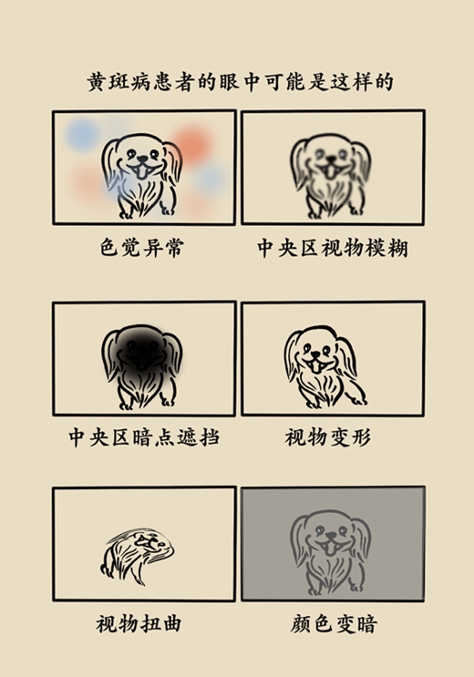 这种致盲性眼底疾病，一张纸就可识别983 / 作者:UFO爱好者 / 帖子ID:72928