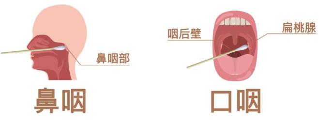 核酸检测新冠病毒的常用手段：口腔拭子、鼻腔拭子检测图示987 / 作者:UFO爱好者 / 帖子ID:70657