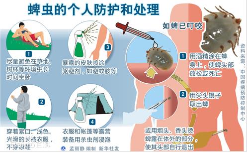 蜱虫咬后有什么症状？蜱虫个人防护与处理？如何不被蜱虫叮咬668 / 作者:UFO爱好者 / 帖子ID:69085