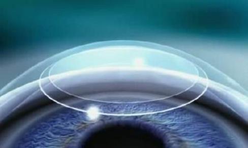 人为什么会近视？有哪些症状？近视眼矫正方法有哪些？570 / 作者:UFO爱好者 / 帖子ID:69533