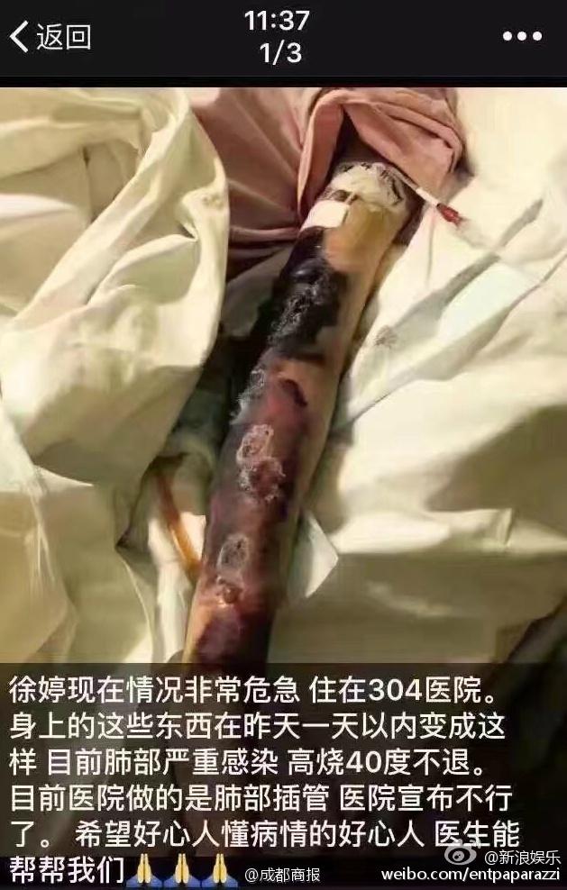 女演员徐婷死亡之谜814 / 作者: / 来源: